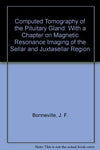 Computed Tomography Of The Pituitary Gland