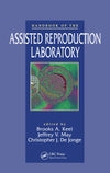 Handbook of the Assisted Reproduction Laboratory: 1st Edition
