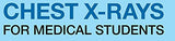 Chest X-Rays for Medical Students: CXRs Made Easy