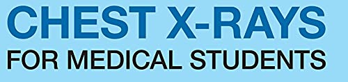 Chest X-Rays for Medical Students: CXRs Made Easy