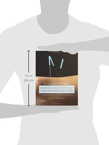 Acupuncture for IVF and Assisted Reproduction: An integrated approach to treatment and management