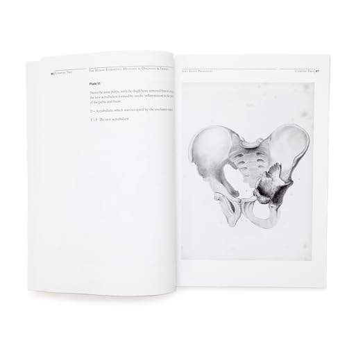 The Human Extremities: Mechanical Diagnosis and Therapy