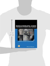 Musculoskeletal X-Rays for Medical Students and Trainees: 1st Edition