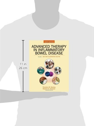 Advanced Therapy of Inflammatory Bowel Disease: IBD and Ulcerative Colitis