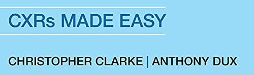 Chest X-Rays for Medical Students: CXRs Made Easy