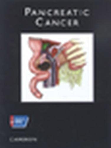Atlas of Clinical Oncology: Pancreatic Cancer