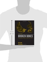 Broken Bones: Anthropological Analysis of Blunt Force Trauma