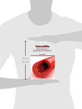 Vasculitis: Developments in Diagnosis and Treatment