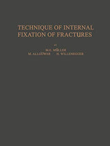 Technique of Internal Fixation of Fractures
