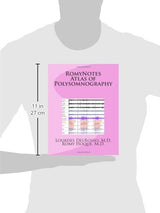RomyNotes Atlas of Polysomnography
