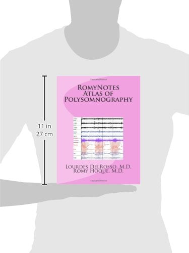 RomyNotes Atlas of Polysomnography