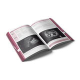 Pocket Radiology: An essential pocket-sized book on diagnostic imaging and radiographic findings. (Compendium Medicine)