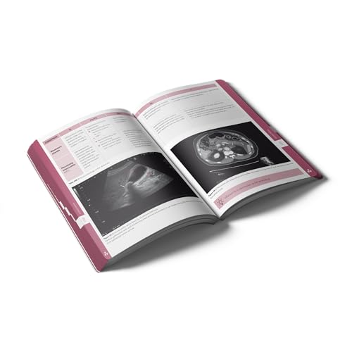Pocket Radiology: An essential pocket-sized book on diagnostic imaging and radiographic findings. (Compendium Medicine)