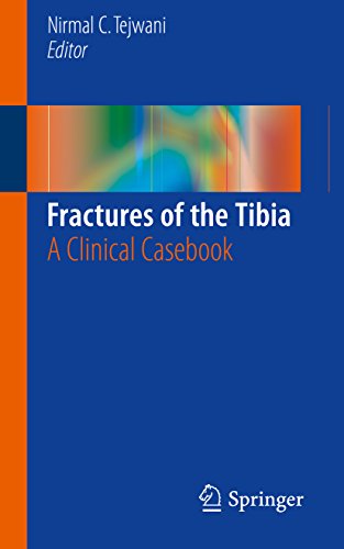 Fractures of the Tibia: A Clinical Casebook: 1st ed. 2016 Edition, Kindle Edition
