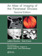 An Atlas of Imaging of the Paranasal Sinuses, Second Edition