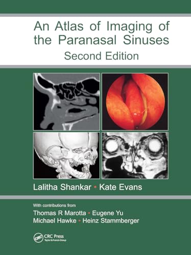 An Atlas of Imaging of the Paranasal Sinuses, Second Edition