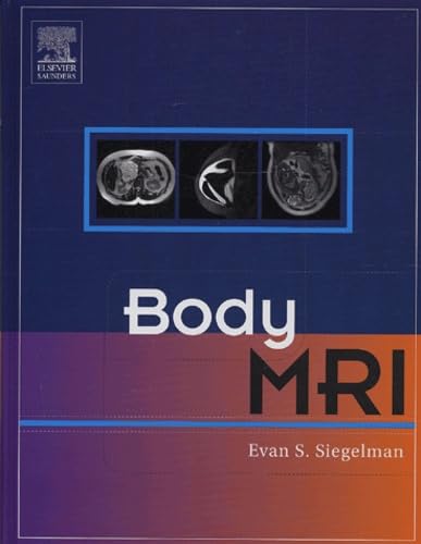 Body MRI: 1st Edition