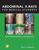 Abdominal X-rays for Medical Students: 1st Edition