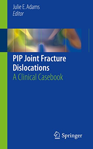 PIP Joint Fracture Dislocations: A Clinical Casebook: 1st ed. 2016 Edition, Kindle Edition