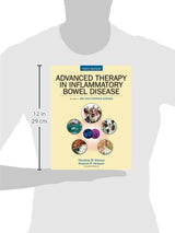 Advanced Therapy of Inflammatory Bowel Disease: IBD and Crohn's Disease