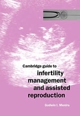 Cambridge Guide to Infertility Management and Assisted Reproduction: 1st Edition