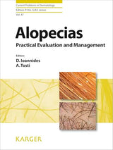 Alopecias - Practical Evaluation and Management (Current Problems in Dermatology Book 47): 1st Edition