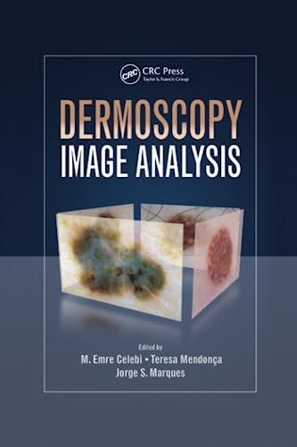 Dermoscopy Image Analysis (Digital Imaging and Computer Vision): 1st Edition