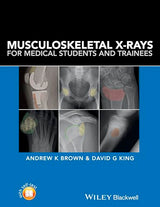 Musculoskeletal X-Rays for Medical Students and Trainees: 1st Edition