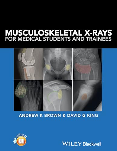 Musculoskeletal X-Rays for Medical Students and Trainees: 1st Edition