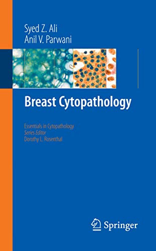 Breast Cytopathology (Essentials in Cytopathology Book 4)