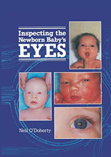 Inspecting the Newborn Baby's Eyes (Atlases of Childhood Series): 1st Edition