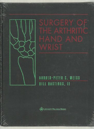 Surgery of the Arthritic Hand and Wrist