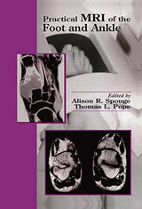 Practical MRI of the Foot and Ankle: 1st Edition