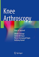 Knee Arthroscopy: How to Succeed: Kindle Edition