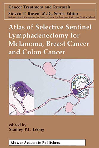 Atlas of Selective Sentinel Lymphadenectomy for Melanoma, Breast Cancer and Colon Cancer Treatment and Research, 111): 2002nd Edition