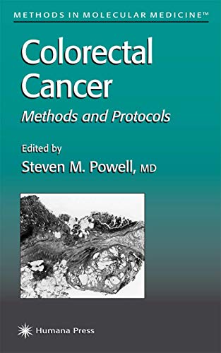 Colorectal Cancer: Methods and Protocols (Methods in Molecular Medicine): Softcover reprint of 1st ed. 2001 Edition