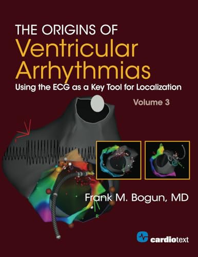 The Origins of Ventricular Arrhythmias: Using the ECG as a Key Tool for Localization