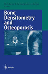 Bone Densitometry and Osteoporosis: 1st Edition
