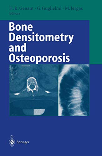 Bone Densitometry and Osteoporosis: 1st Edition