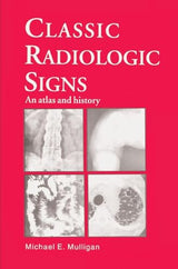 Classic Radiologic Signs: An Atlas and History