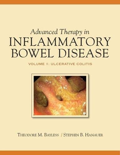 Advanced Therapy of Inflammatory Bowel Disease: IBD and Ulcerative Colitis