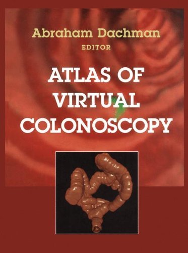 Atlas of Virtual Colonoscopy: 1st Edition