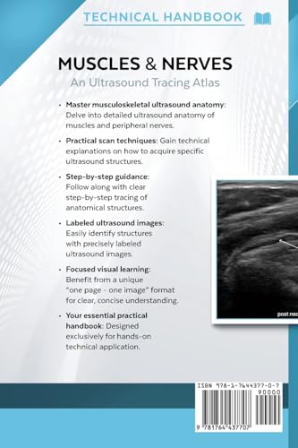 Muscles & Nerves - Technical Ultrasound Handbook: An Ultrasound Tracing Atlas (Series 1) (Technical Ultrasound Handbook - Muscles & Nerves: An Ultrasound Tracing Atlas)