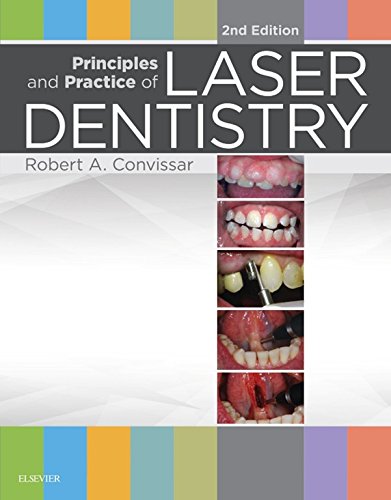 Principles and Practice of Laser Dentistry - E-Book: 2nd Edition, Kindle Edition
