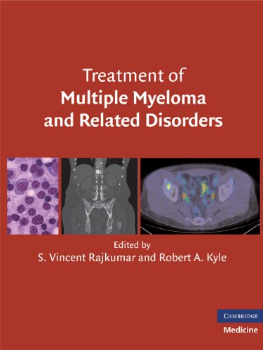 Treatment of Multiple Myeloma and Related Disorders: Illustrated Edition