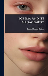 Eczema And Its Management