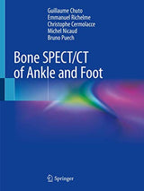 Bone SPECT/CT of Ankle and Foot
