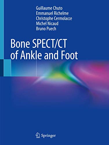 Bone SPECT/CT of Ankle and Foot