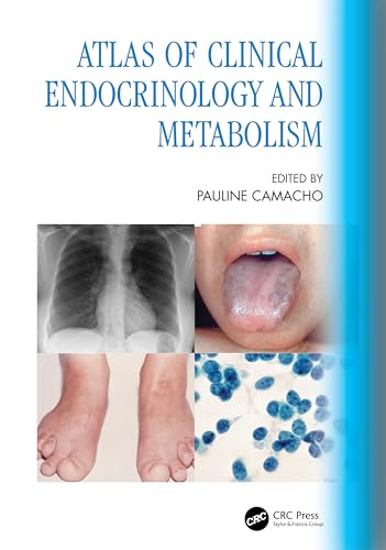 Atlas of Clinical Endocrinology and Metabolism: 1st Edition