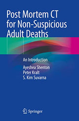 Post Mortem CT for Non-Suspicious Adult Deaths: An Introduction